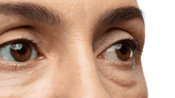 A confident woman with rejuvenated eyes 