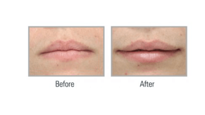 Before and after pictures. 