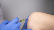 Patient Orthovisc experiences