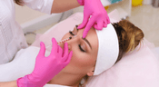 A woman having Dysport treatment 