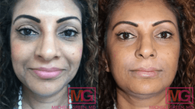 Before and after pictures.