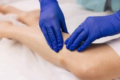 Patient success Orthovisc