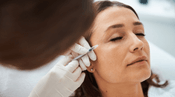 Understanding Crow's Feet and Dysport Treatment