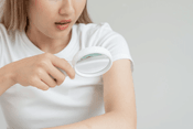 Managing Eczema with Dermalax