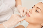 Woman receiving Juvederm lip filler injections by a professional for enhanced aesthetics