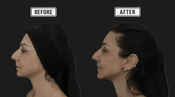 Questions about Results