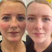 Close-up of a woman's face, with subtle differences between the two images. Both show her with light makeup and rosy cheeks. Her gaze is directed towards the camera.