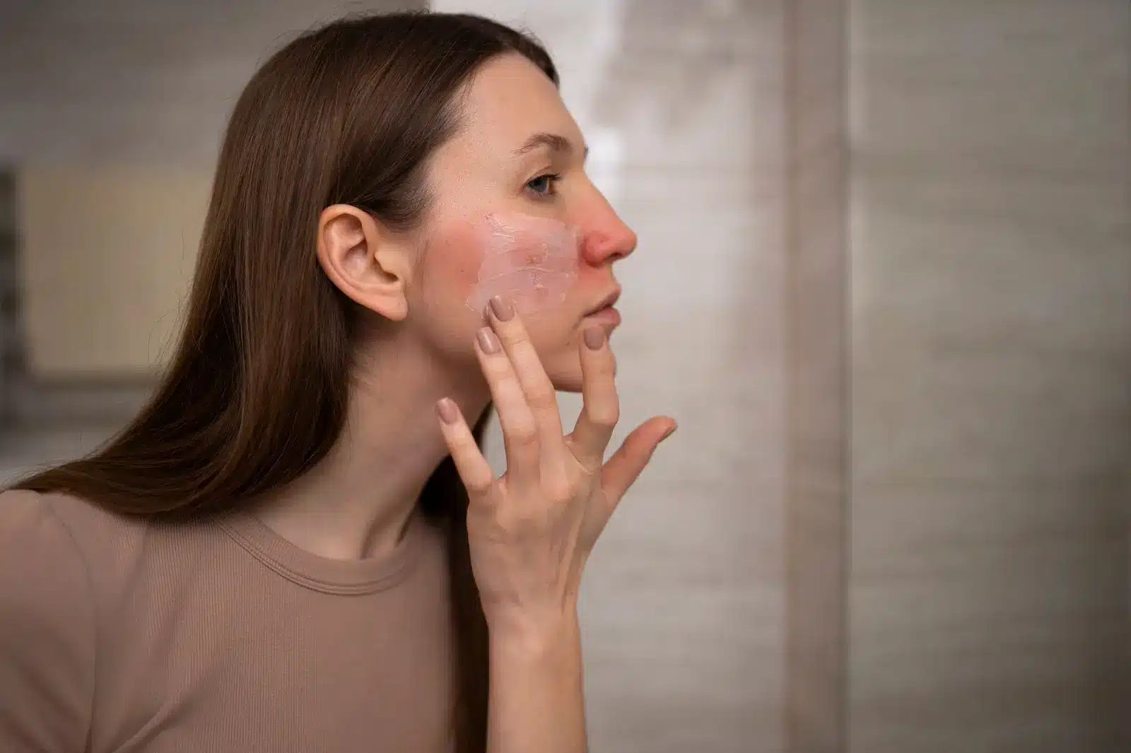 A woman with long brown hair applies cream to her red, irritated cheeks while looking in a bathroom mirror. She appears to be treating facial redness or skin irritation.