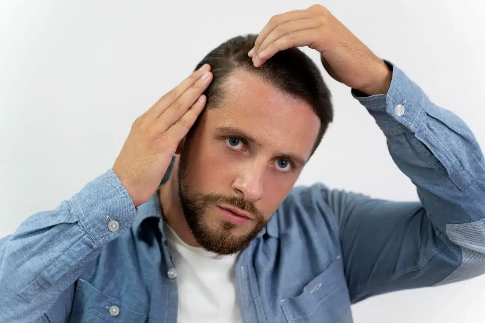 A man with a beard and blue shirt examines his hairline in the mirror, using both hands to pull back his hair and look closely at his scalp.