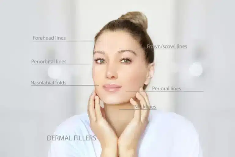 A woman with her hair in a bun gently touches her face with both hands. Labels indicating facial areas for potential dermal fillers include forehead lines, frown/scowl lines, periorbital lines, nasolabial folds, perioral lines, and neck lines. Text reads "DERMAL FILLERS.