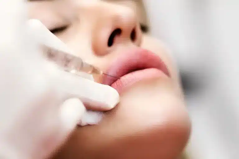 Close-up of a person receiving a cosmetic lip injection with a syringe. The person has their eyes closed, and a gloved hand is administering the injection into the upper lip. The background is blurred.