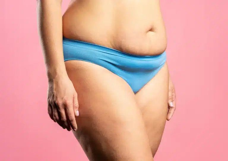A person wearing blue underwear is seen from the waist down, standing against a pink background. The individual, possibly considering Aqualyx treatments, has a visible stomach with soft folds and slightly parted legs.
