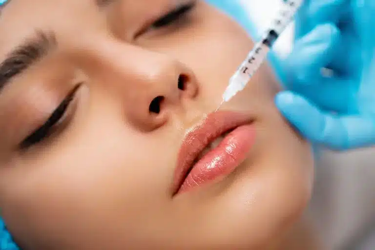 Close-up of a person receiving a lip injection at AMWC 2023. The individual lies down with closed eyes as a syringe is applied to their upper lip by someone wearing blue gloves. They appear relaxed, highlighting the clinical and professional nature of the cosmetic procedure.