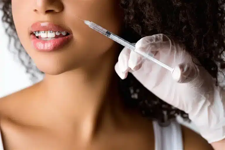 mss-dermal-fillers-in-dental-settings