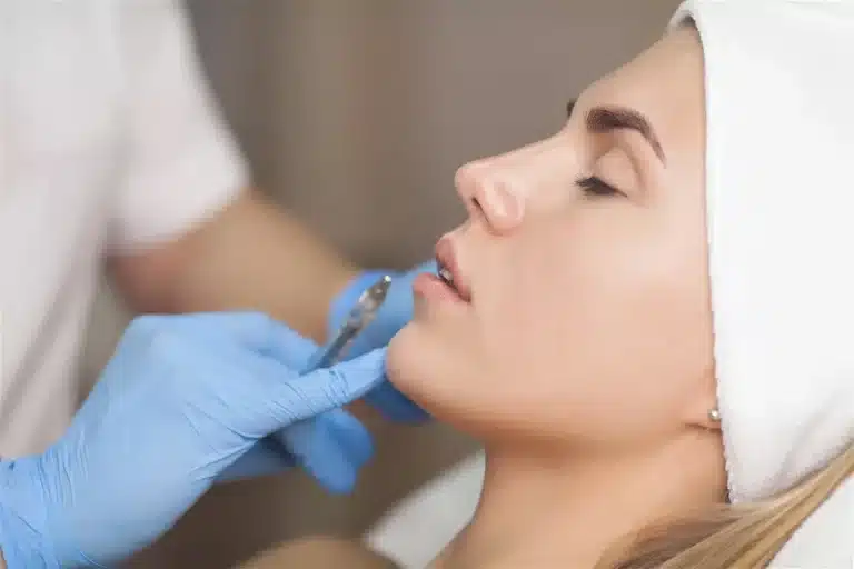mss-dissolving-lip-filler