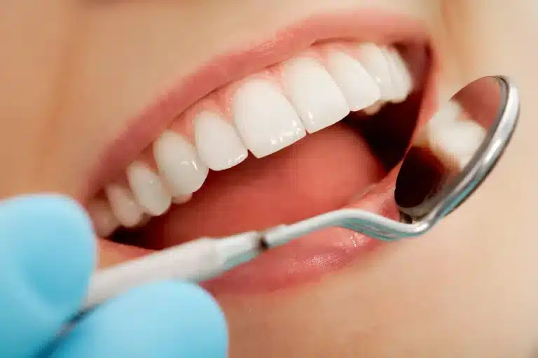 closeup of dentist's exam on woman's teeth