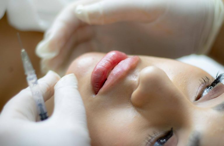 closeup of a woman getting a lip filler treatment