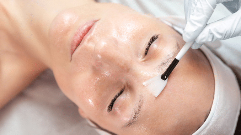 Client receiving a chemical peel treatment.