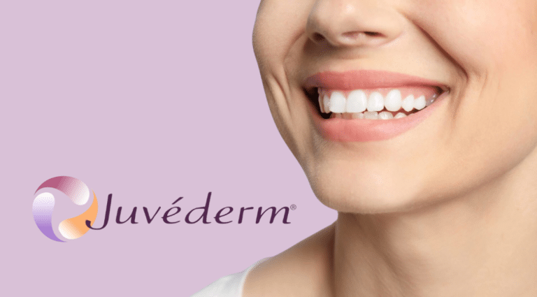 Juvederm Smile for Gummy Smile: How to Correct Excessive Gum Exposure