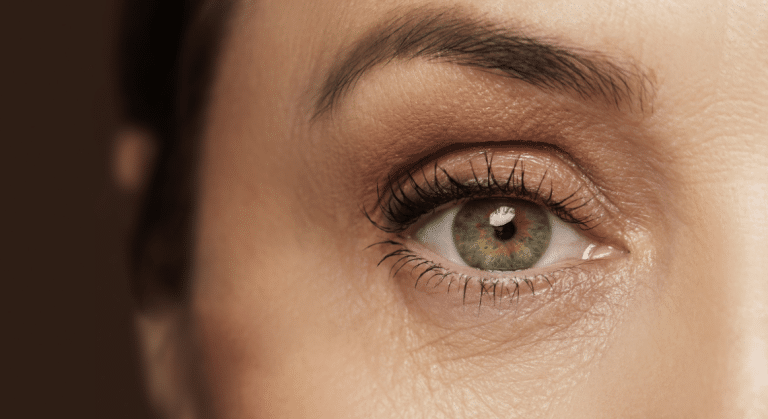 The Eye-Opening Truth: Exploring the Use of Dysport Under the Eyes