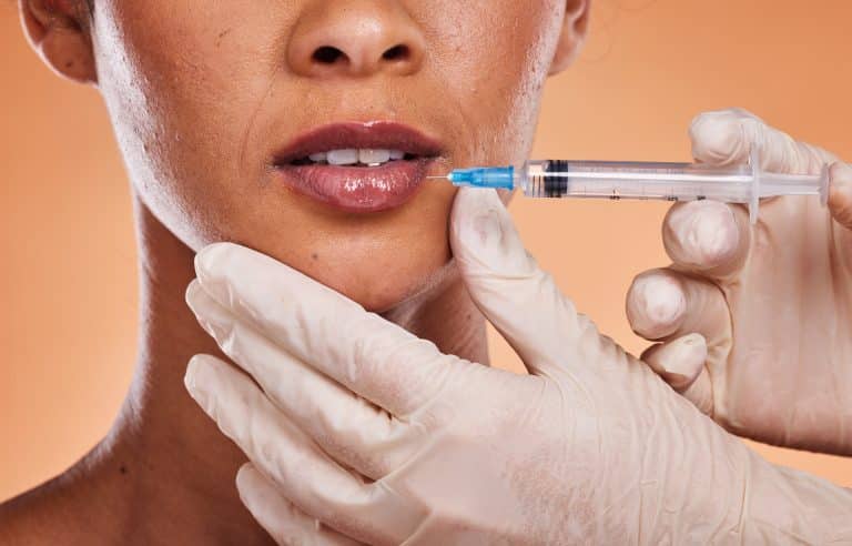 Botox results timeline