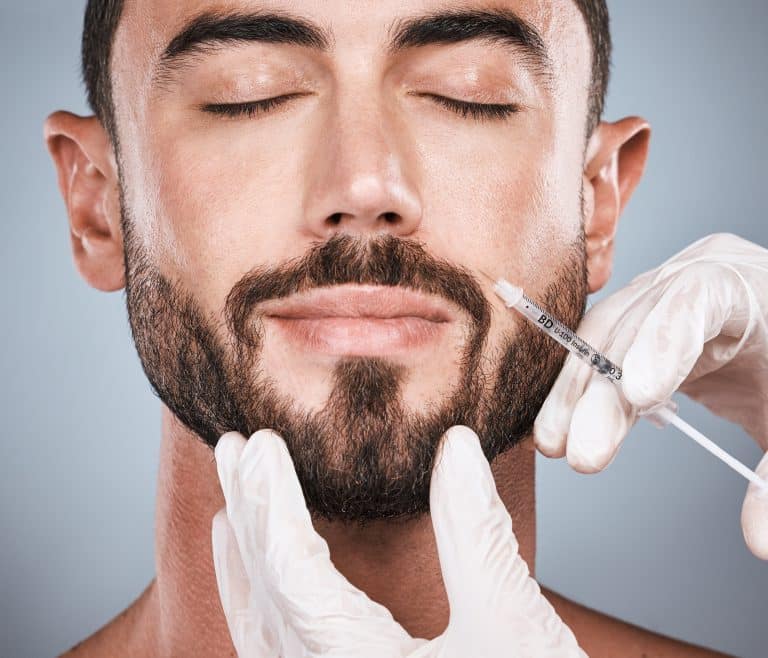 lip fillers for men