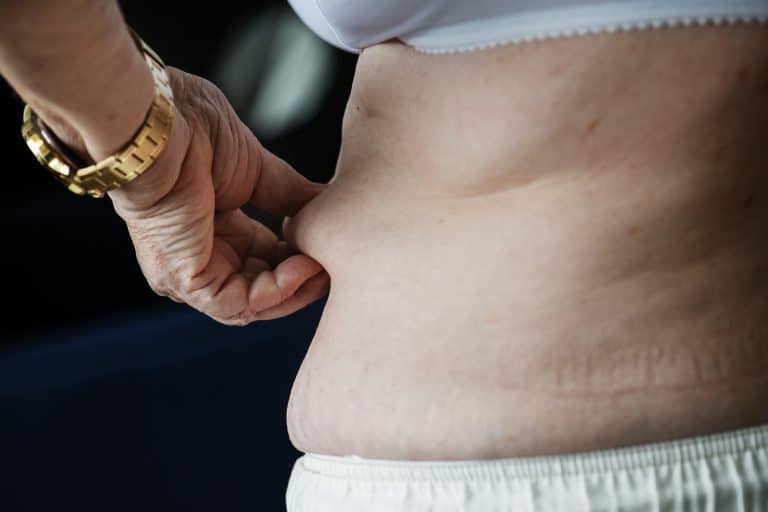 sagging tummy