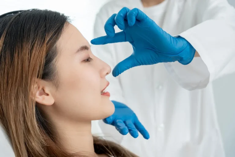 teosyal nose filler