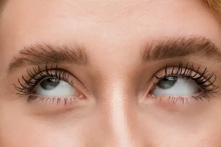 Lumigan vs Latanoprost