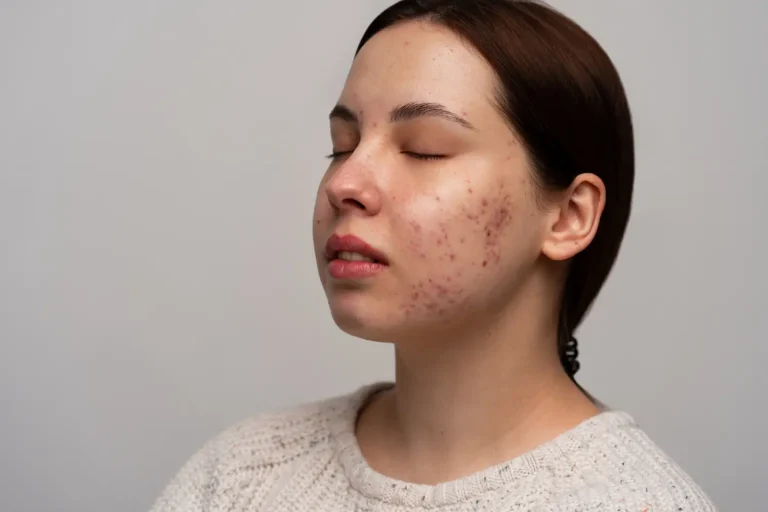 Liztox side effects