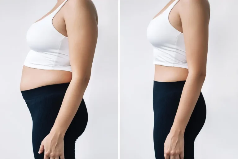 Ozempic before and after