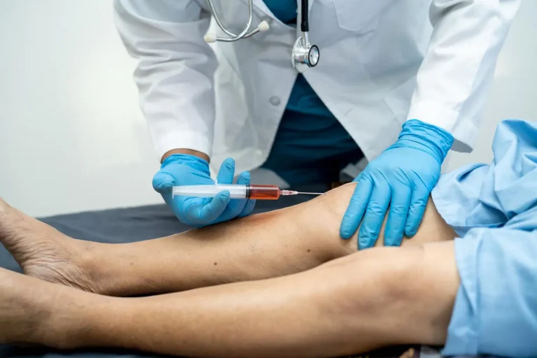 Orthovisc dosage