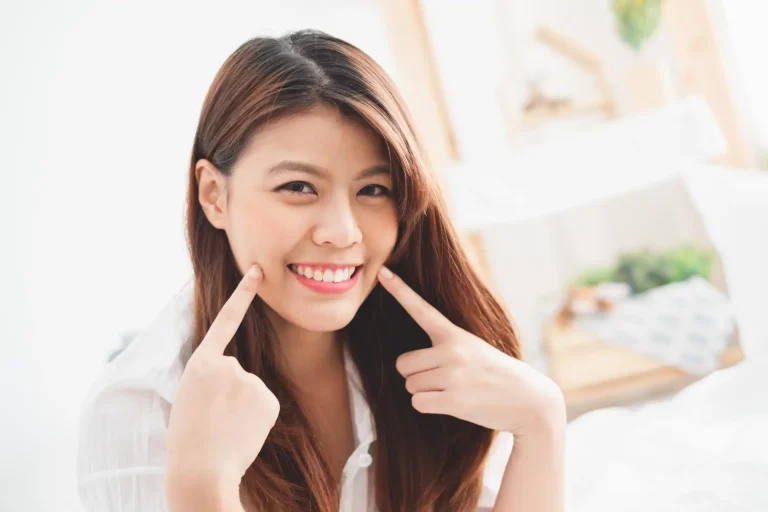 Revolax for nasolabial folds
