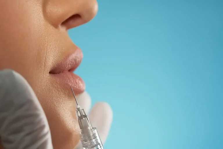 Person getting a lip injection.