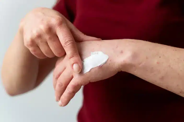 A person wearing a maroon shirt applies a white cream onto the back of their hand with their index finger. The focus is on the hands against a plain background.