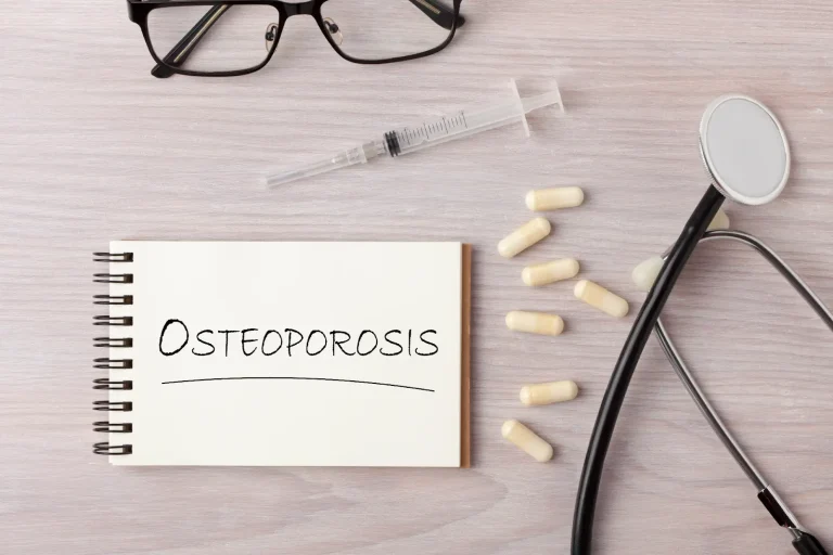 A notepad with “OSTEOPOROSIS” written on it lies on a desk next to a stethoscope, syringe, several white capsules, and a pair of black glasses.