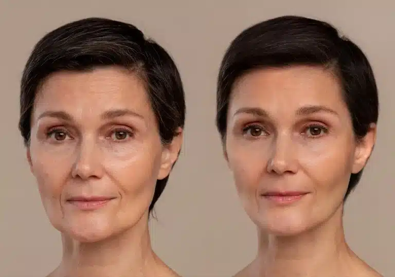 Side-by-side portraits of a middle-aged woman with short dark hair; the left image shows natural skin with wrinkles, and the right image shows smoother, more youthful skin, likely edited or after treatment.
