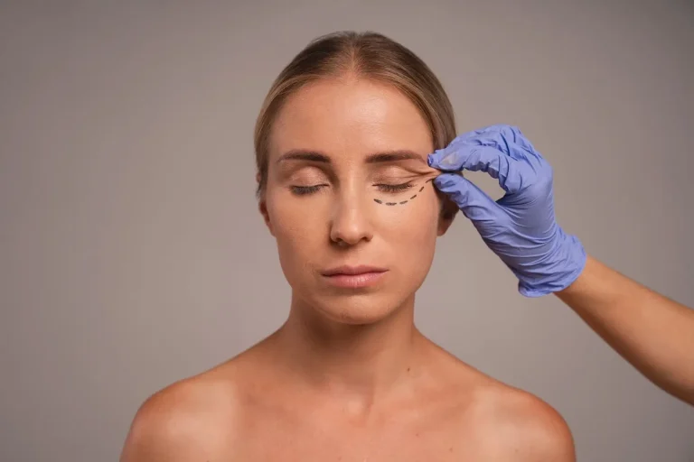 A woman with closed eyes faces forward as a gloved hand gently touches her eyebrow. There are black surgical markings under her right eye, indicating preparation for a cosmetic procedure.