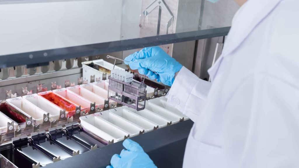A lab technician in a white coat and blue gloves handles a metal rack of microscope slides above trays containing various colored liquids, likely used for staining samples.