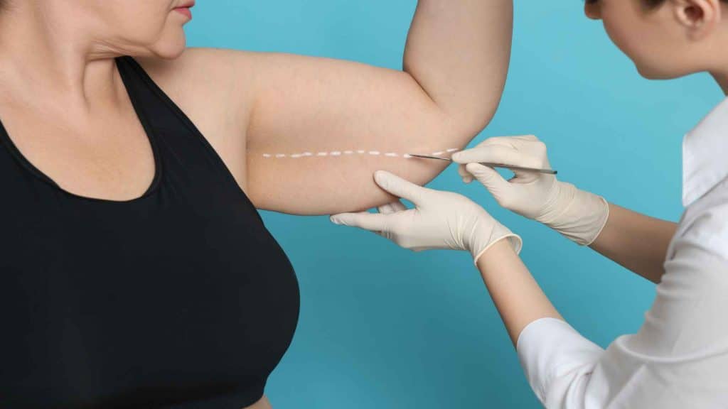 A medical professional uses a surgical marker to draw a dashed line on a woman’s upper arm in preparation for a procedure.