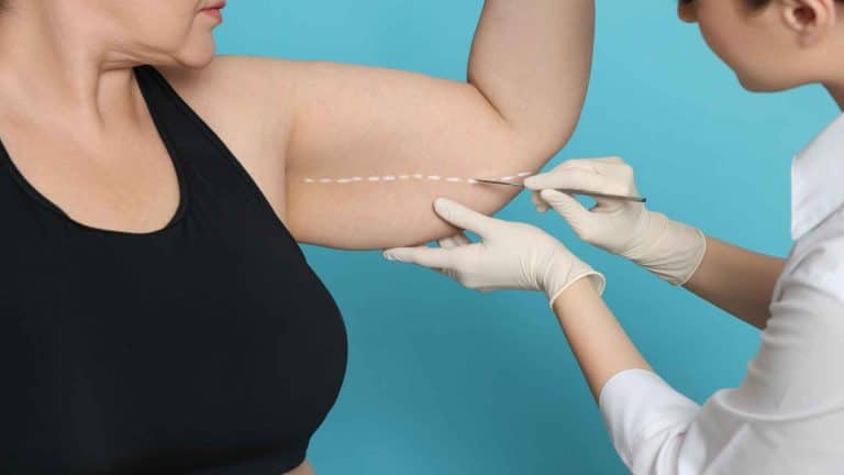 A medical professional uses a surgical marker to draw a dashed line on a woman’s upper arm in preparation for a procedure.