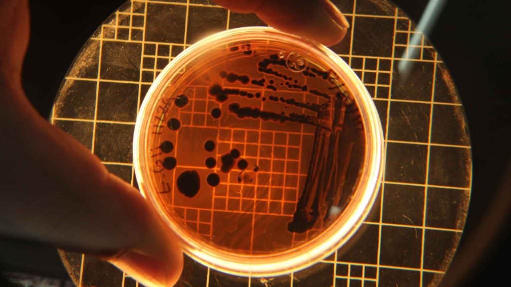 A petri dish containing dark bacterial colonies, held over a light box with a grid pattern.